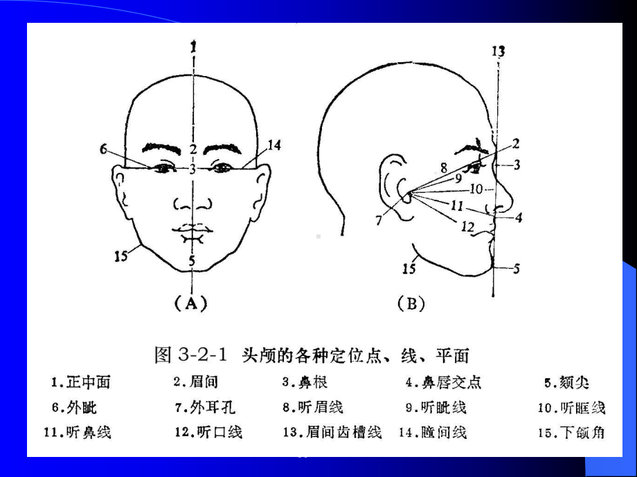 头颅X线摄影课件.ppt_第3页