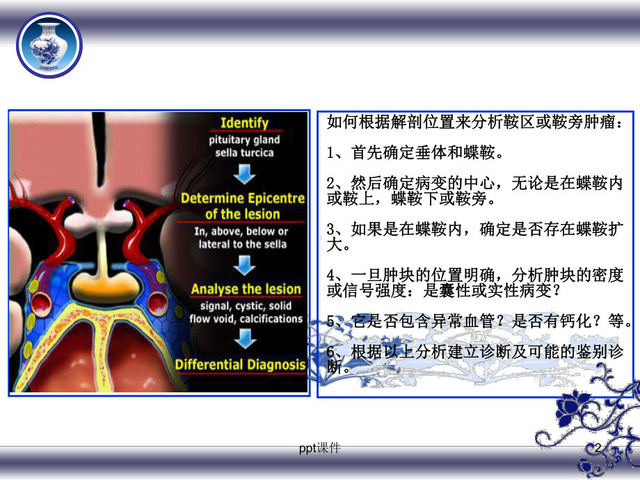 垂体及周围解剖及疾病课件.ppt_第2页