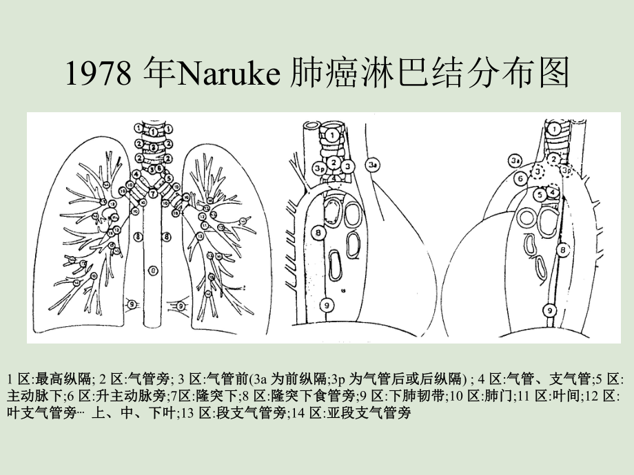 肺癌根治术中的纵隔淋巴结清扫课件.ppt_第3页