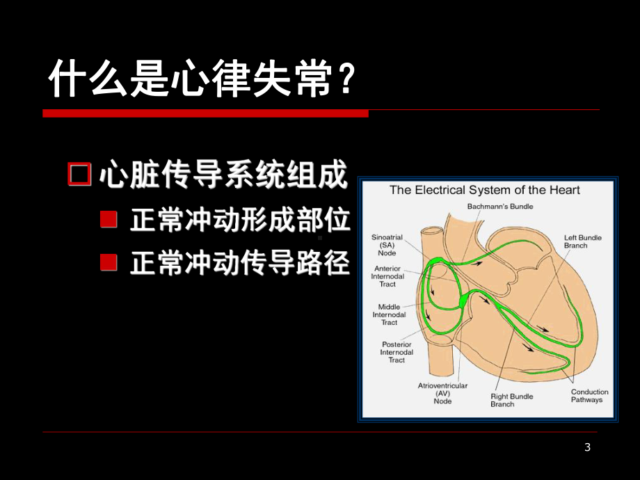 内科学：心律失常课件.ppt_第3页