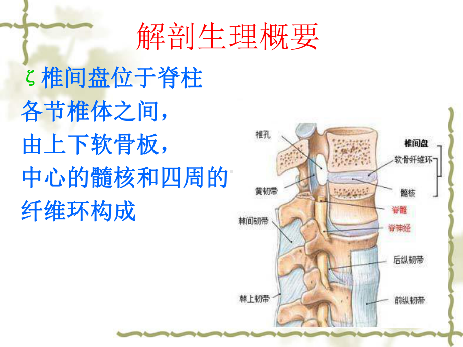 腰椎间盘突出症护理演示教学课件.ppt_第2页