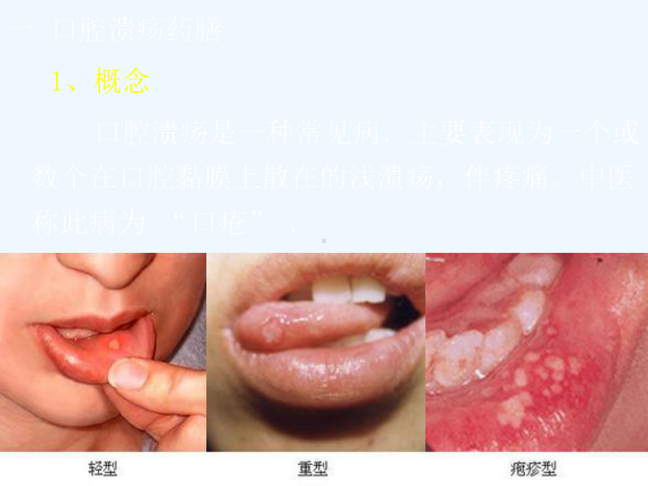 食疗与养生药膳学概论4课件.ppt_第2页