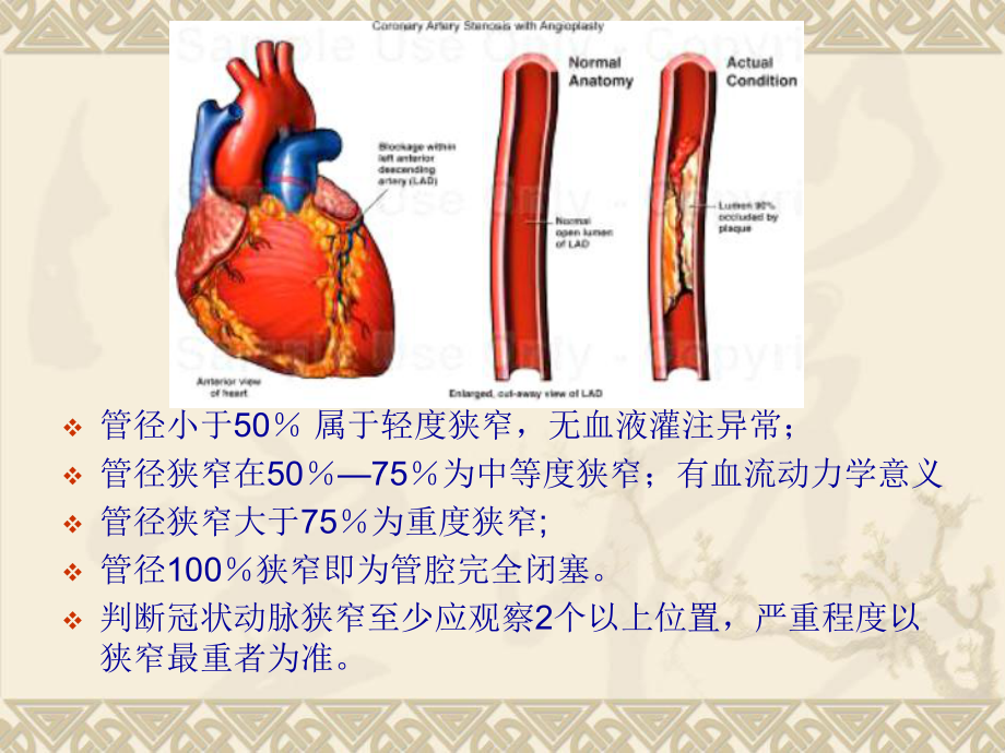 后天性心脏病的X线诊断4后心课件.ppt_第3页