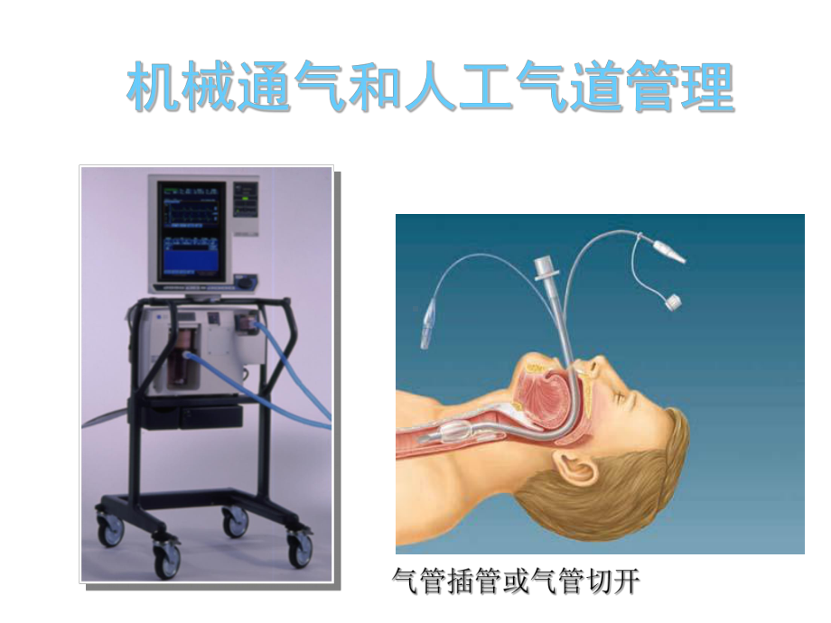 肺泡毛细血管膜结构课件.ppt_第1页