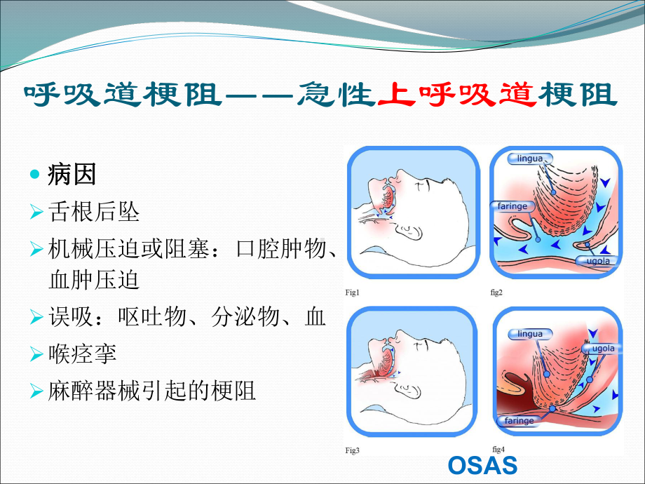 麻醉期间呼吸管理课件.ppt_第3页