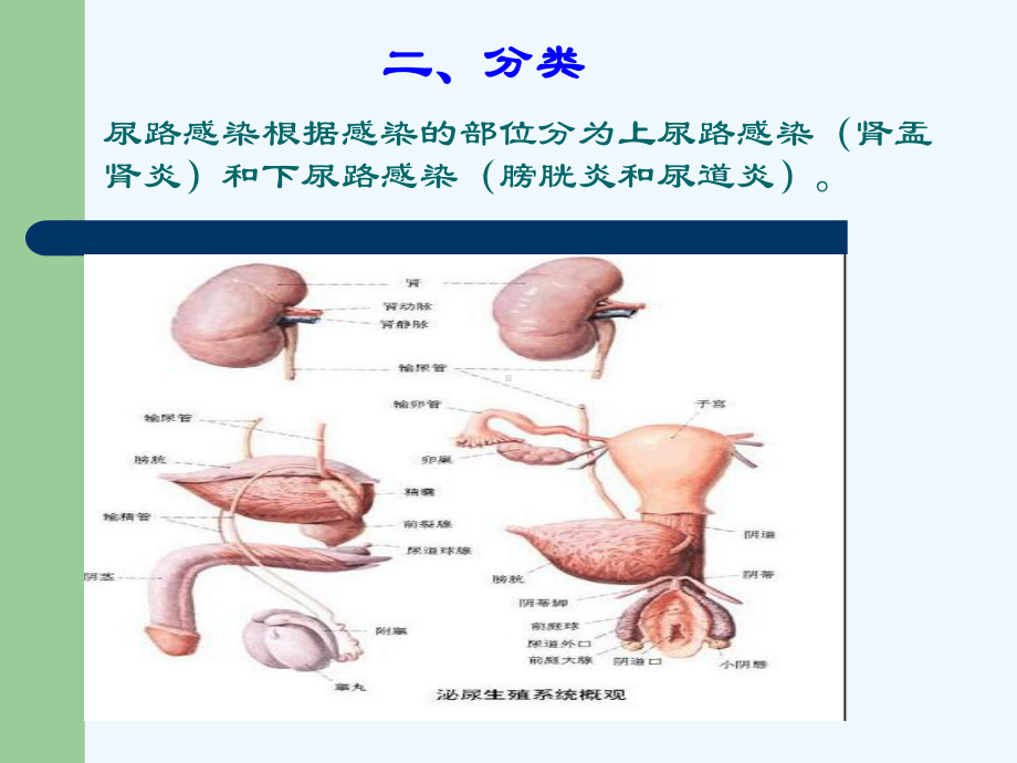 下尿路感染的特点及其诊治现状课件.ppt_第3页