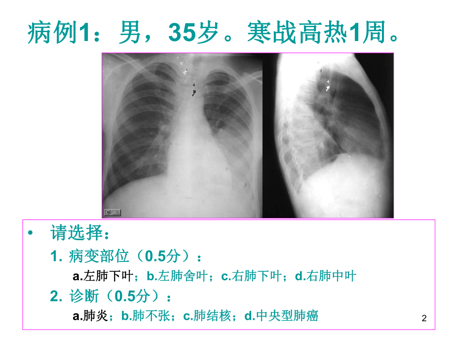 医师资格考试技能-影像试题参考资料课件.ppt_第2页