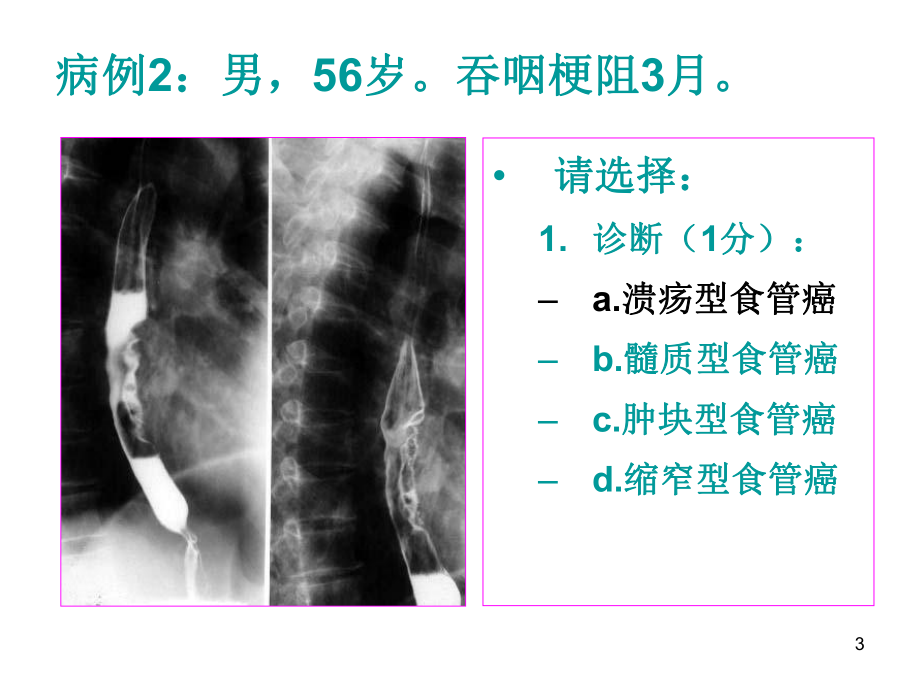 医师资格考试技能-影像试题参考资料课件.ppt_第3页