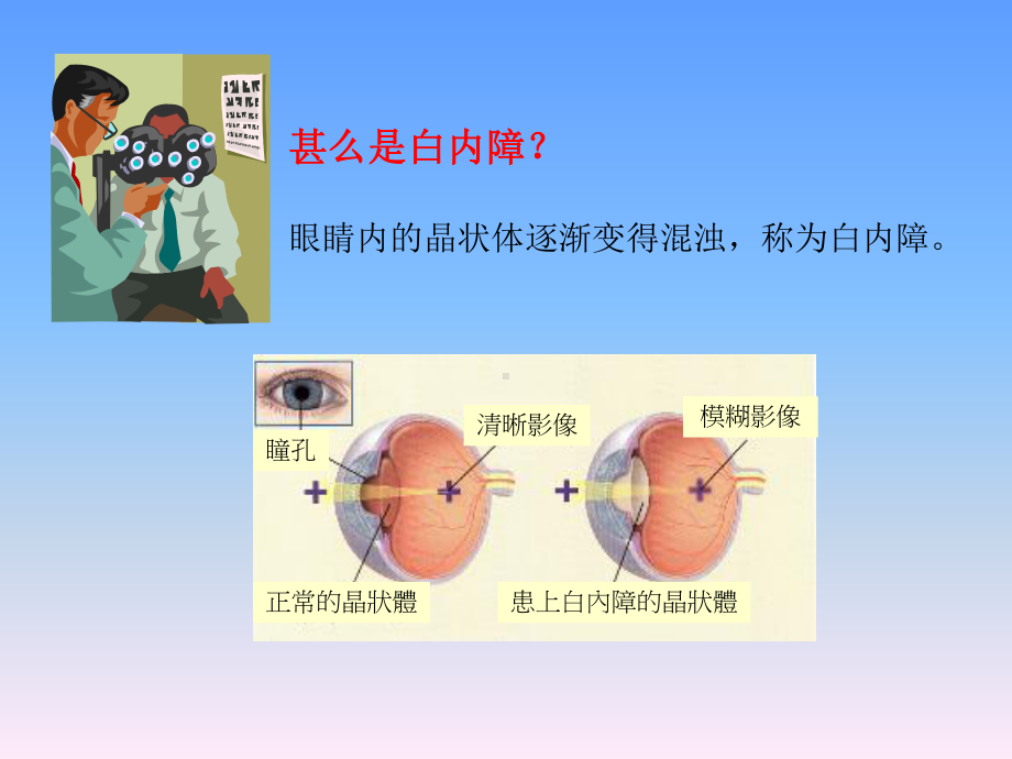 在白内障手术中课件.ppt_第2页