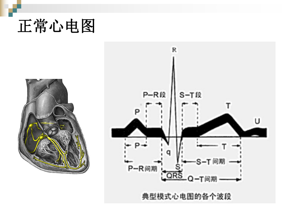 严重心律失常的急救与护理演示教学课件.ppt_第3页