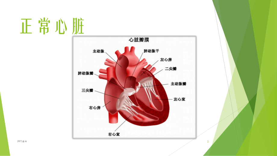 左房粘液瘤课件.ppt_第2页