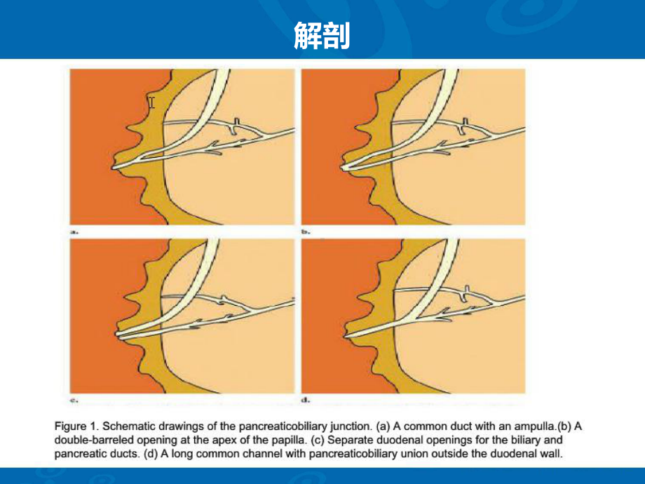 壶腹周围癌CT诊断-影像FTP课件.ppt_第3页