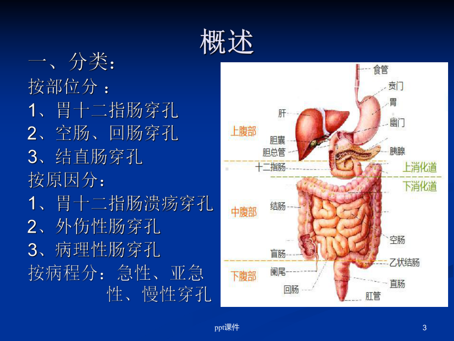 消化道穿孔（肠外科）课件.ppt_第3页