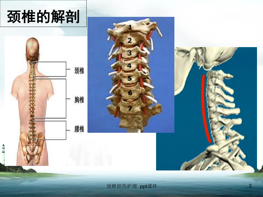 颈椎损伤护理课件.ppt_第3页