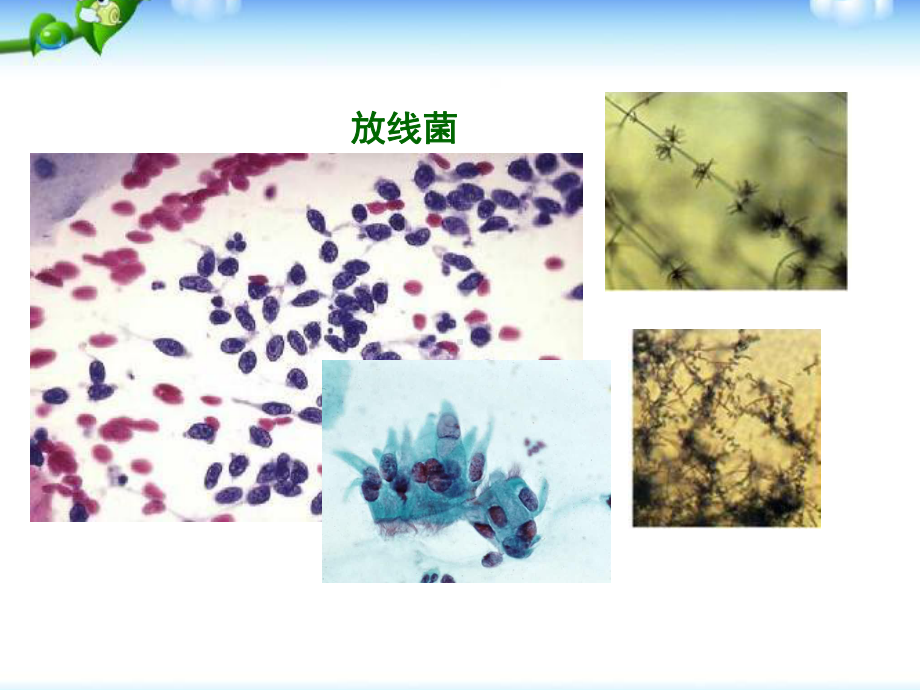 最新课题1-微生物的实验室培养课件.ppt_第3页