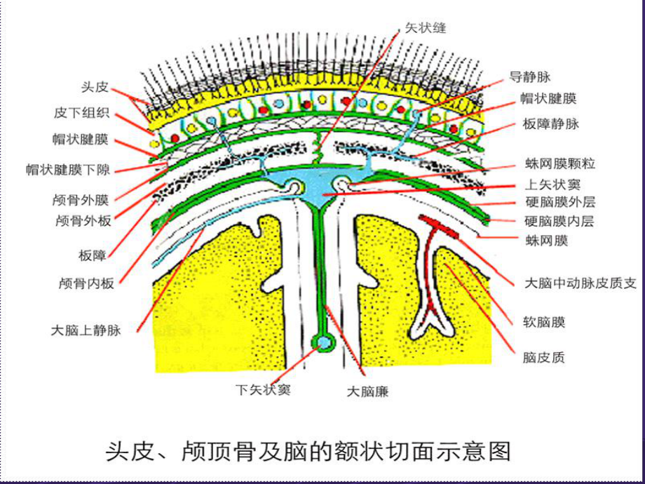 颅脑损伤的手术配合教学课件.ppt_第3页