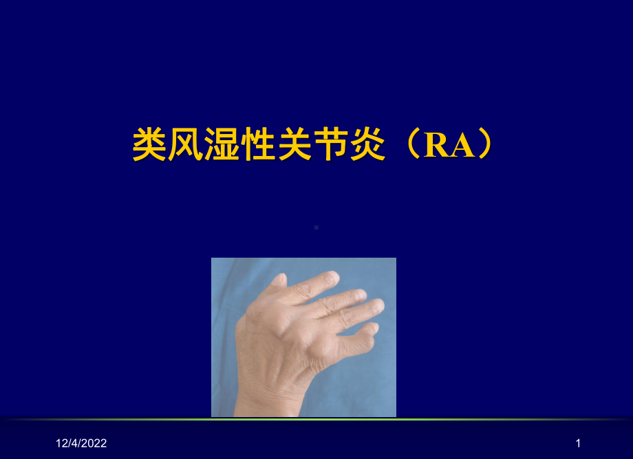 内科学课件类风湿性关节炎共84页资料.ppt_第1页