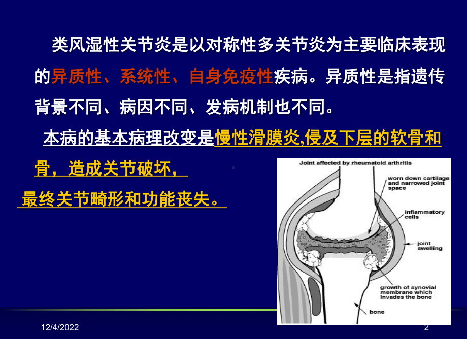 内科学课件类风湿性关节炎共84页资料.ppt_第2页