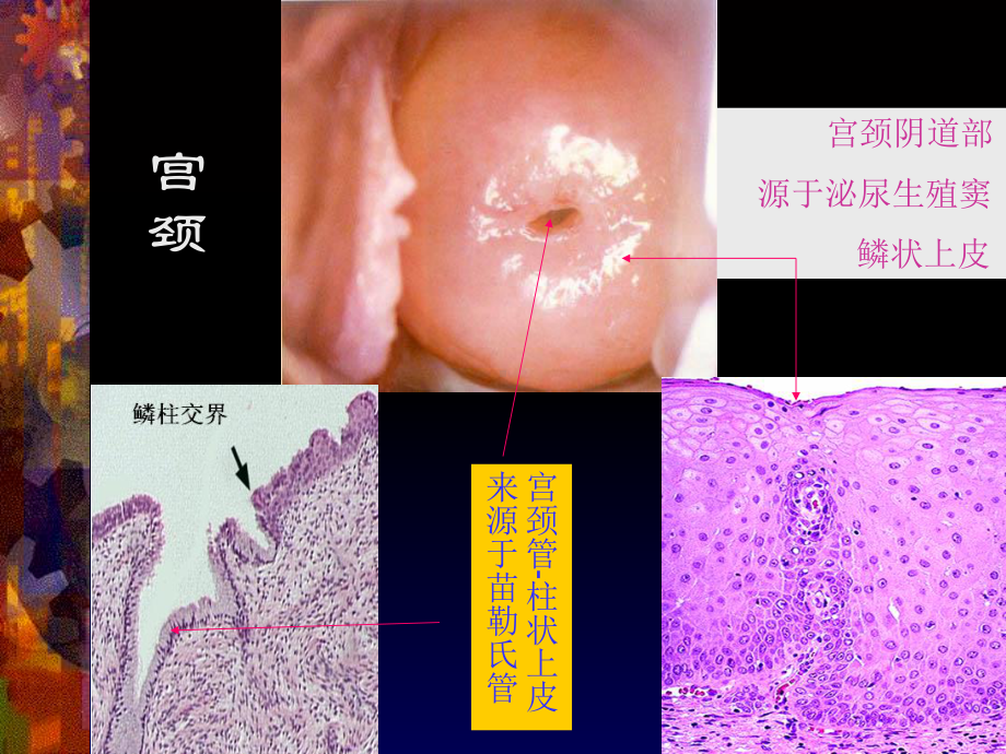 宫颈病变的诊断及治疗课件.ppt_第3页