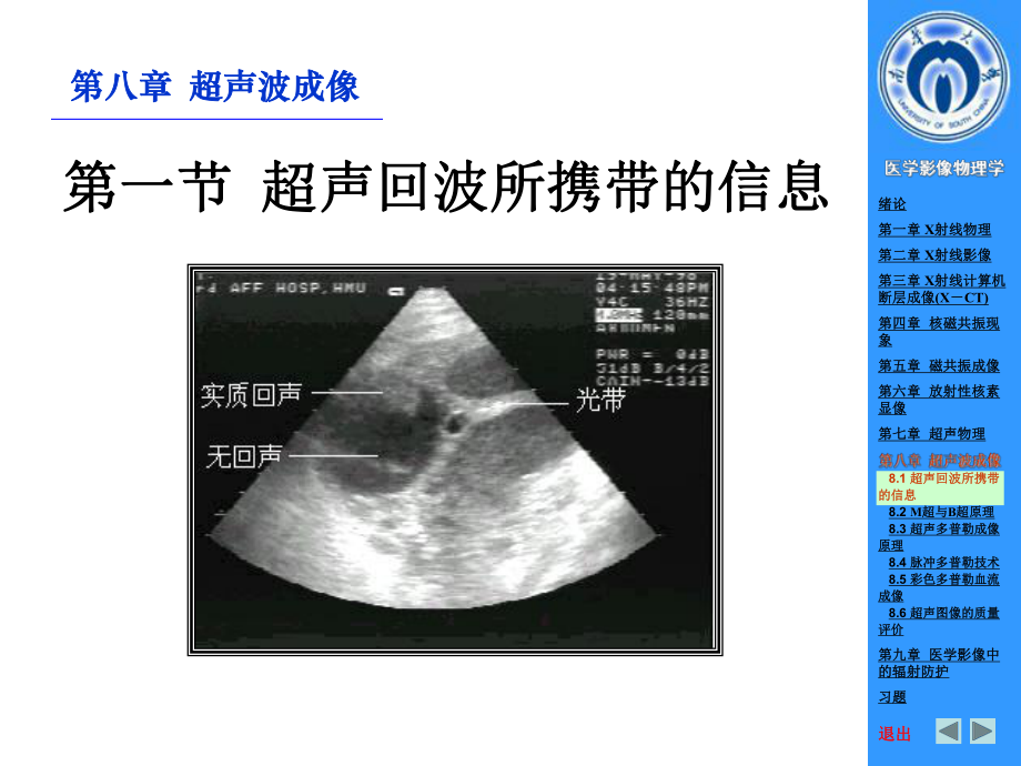 彩色多普勒血流成像超声波成像课件.ppt_第2页