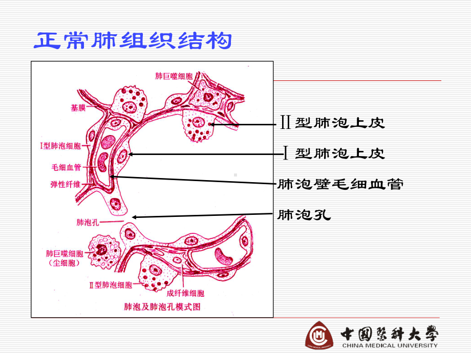 病理学第九章-呼吸系统疾病课件.ppt_第3页