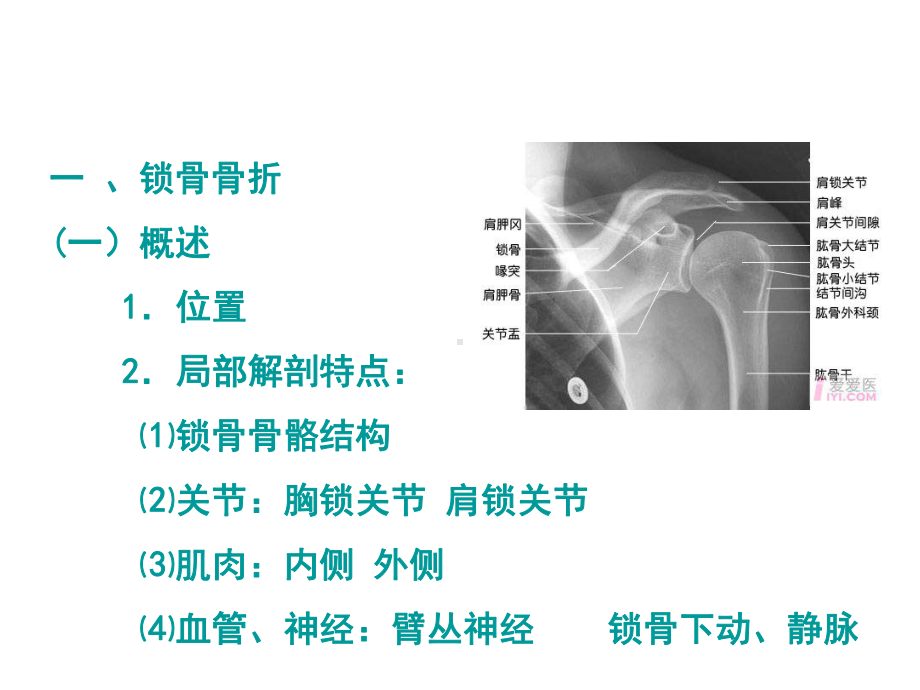 常见骨折及治疗课件.ppt_第3页