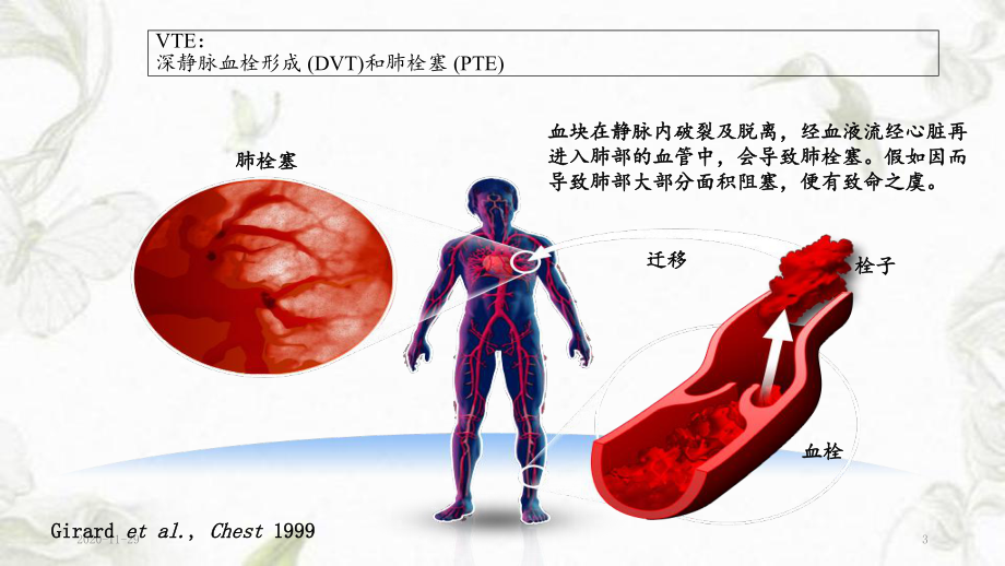 静脉血栓防治解读(实用课件).ppt_第3页