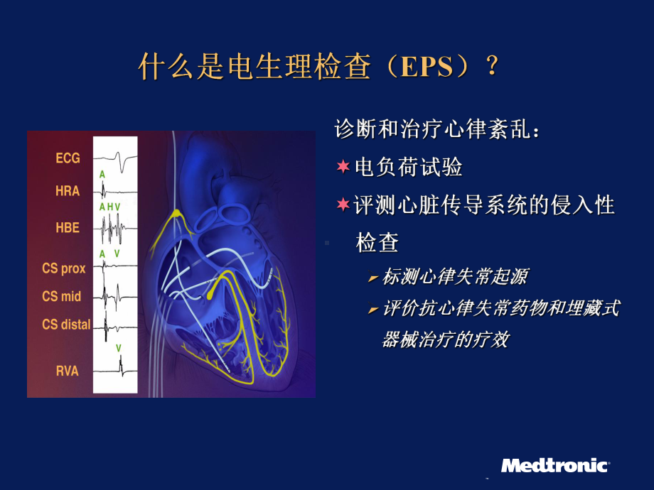 电生理检查课件.ppt_第2页