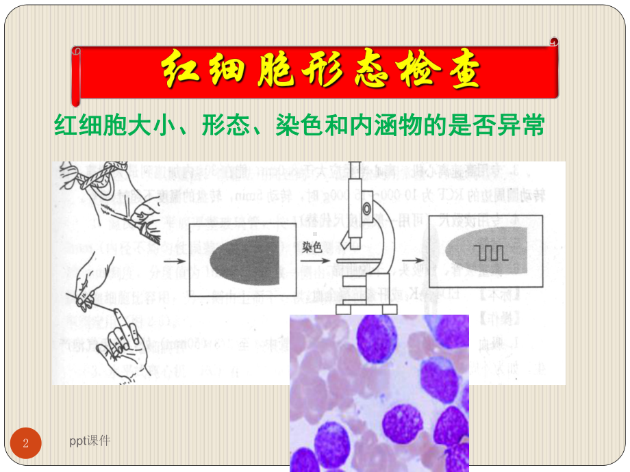 红细胞形态学检验课件.ppt_第2页