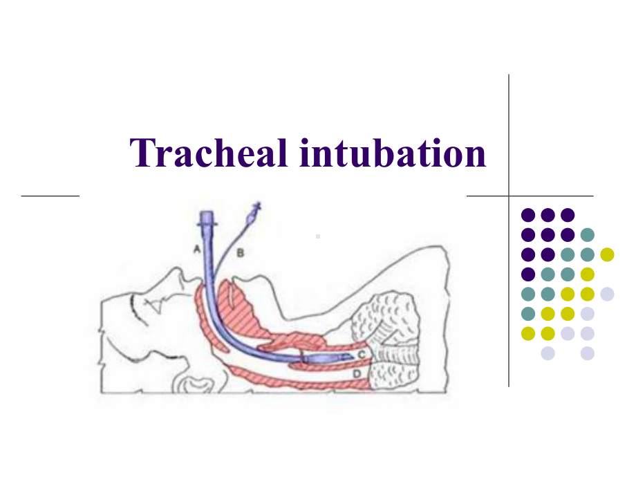 气管插管英文版课件.ppt_第2页