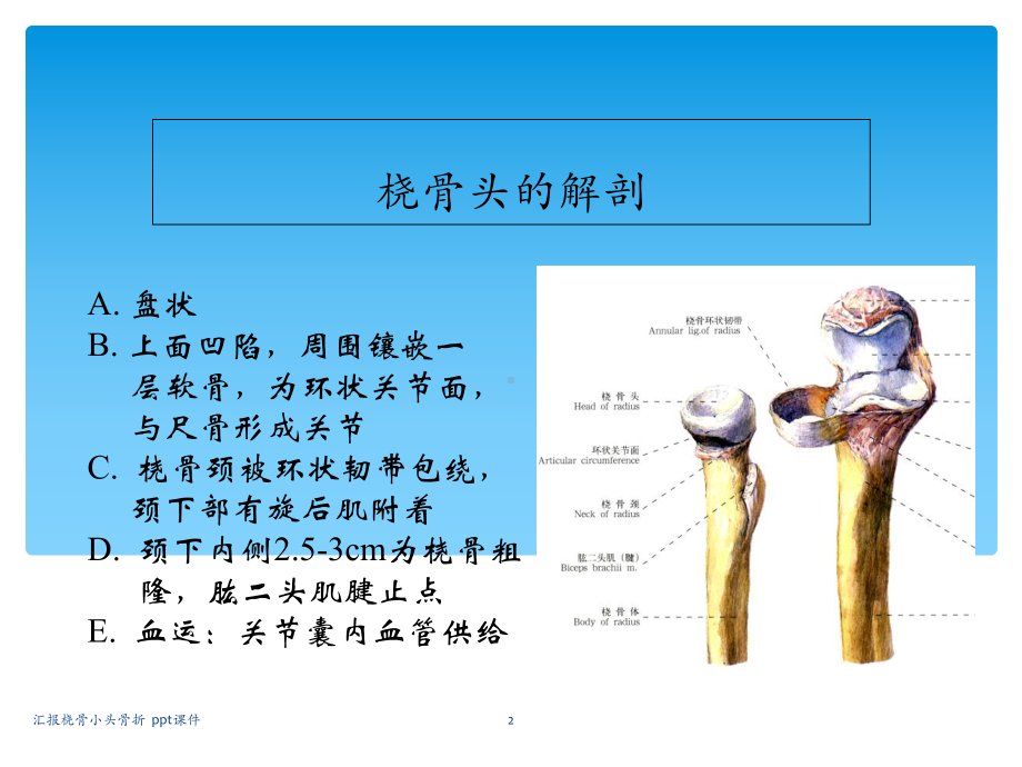 汇报桡骨小头骨折课件.ppt_第2页