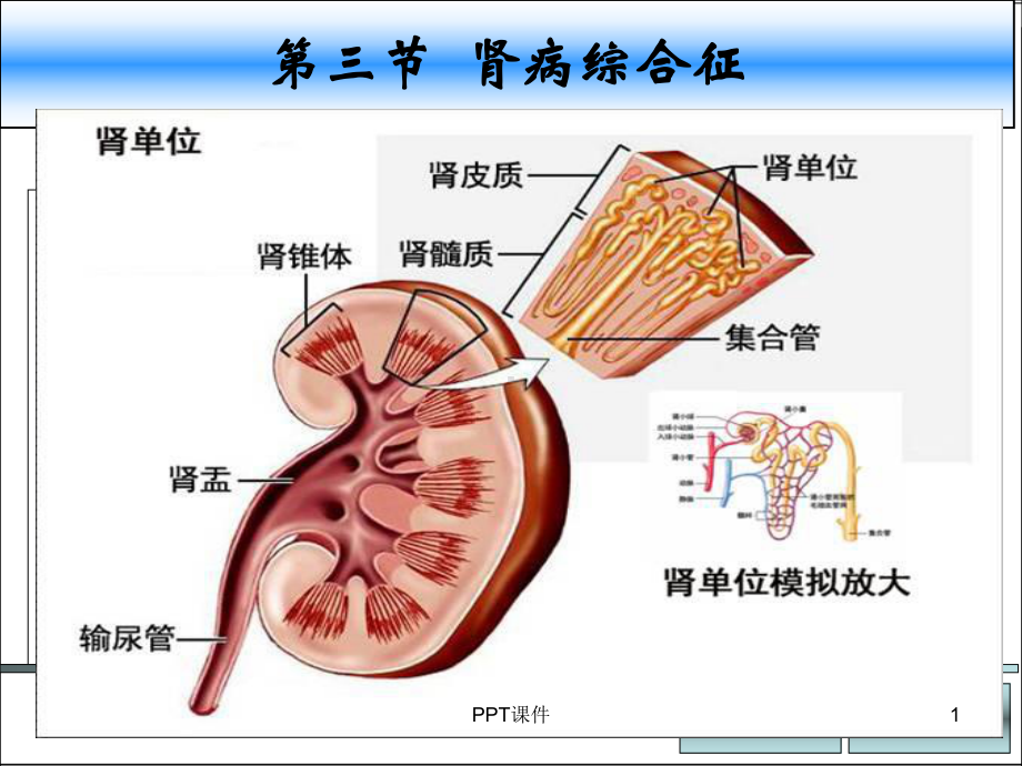 肾病综合征课件-2.ppt_第1页