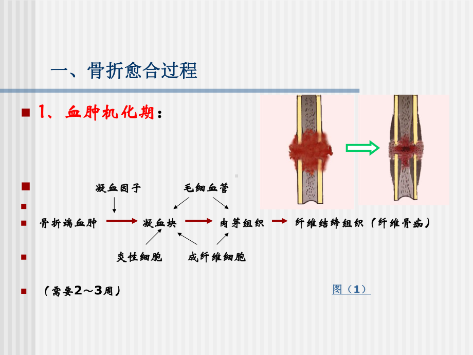 骨折愈合过程课件.ppt_第2页