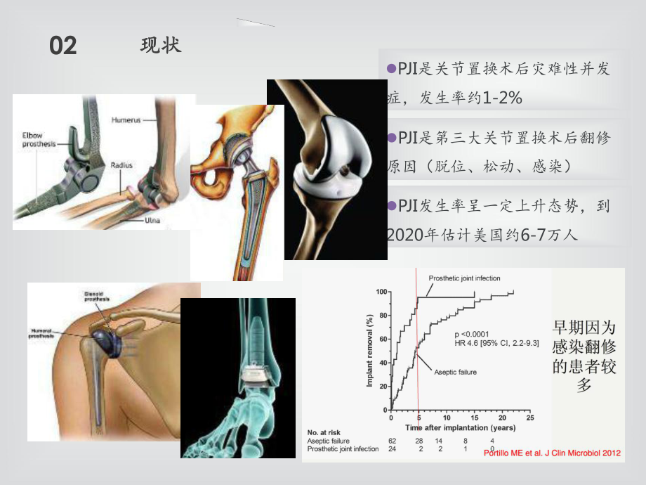 细菌学培养阴性的关节假体周围感染课件.ppt_第3页