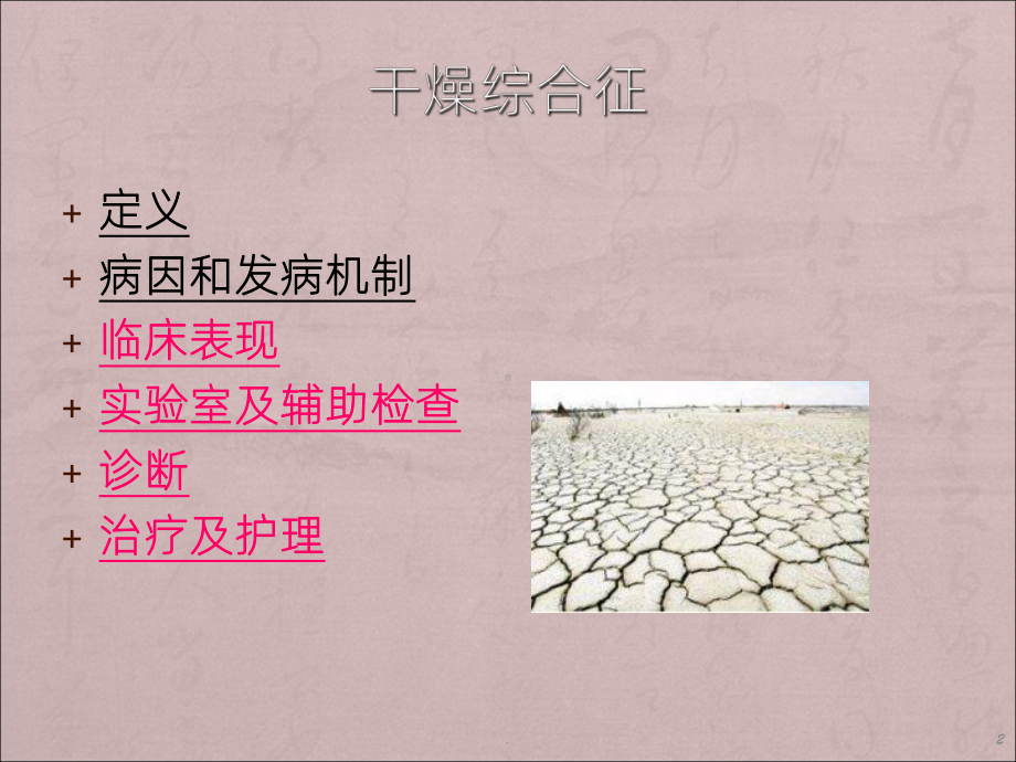 《干燥综合征》课件.ppt_第2页