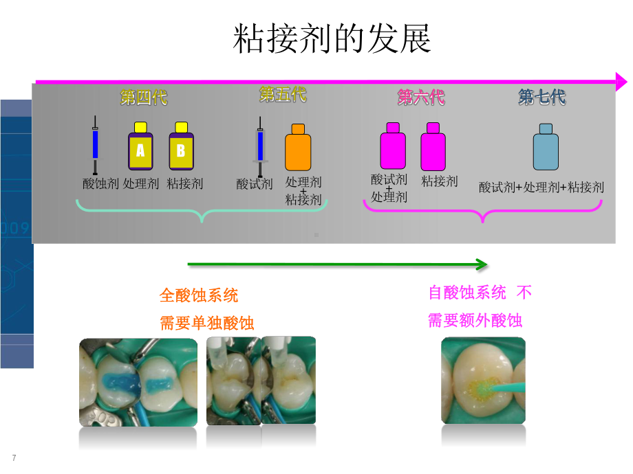 3M树脂微创美学修复课件.ppt_第3页