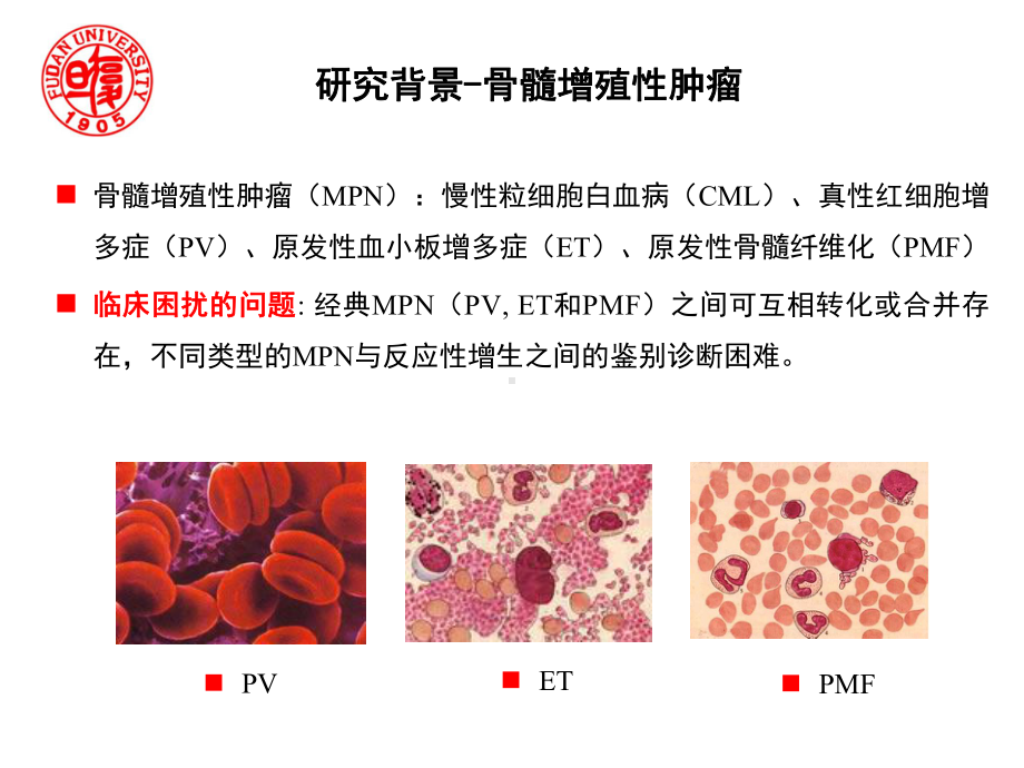 01关明 LAMP微流控芯片即时检测骨髓增殖性肿瘤分子标志物(厦门)课件.ppt_第2页