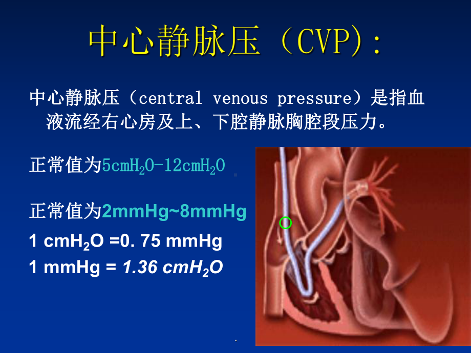 中心静脉压CV监测及波形分析课件.ppt_第3页