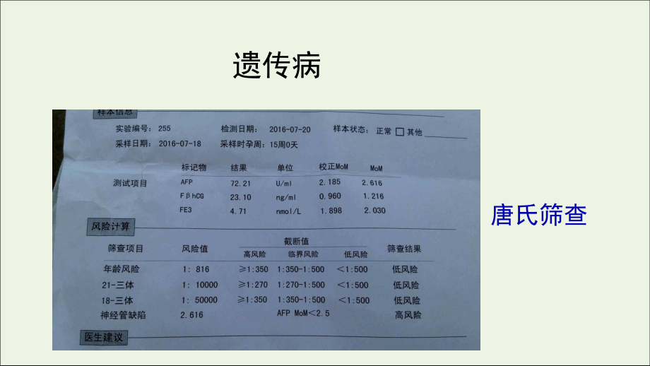 2021学年高中生物第四章生物的变异第四节人类遗传病是可以检测和预防的课件2浙科版必修2.ppt_第2页