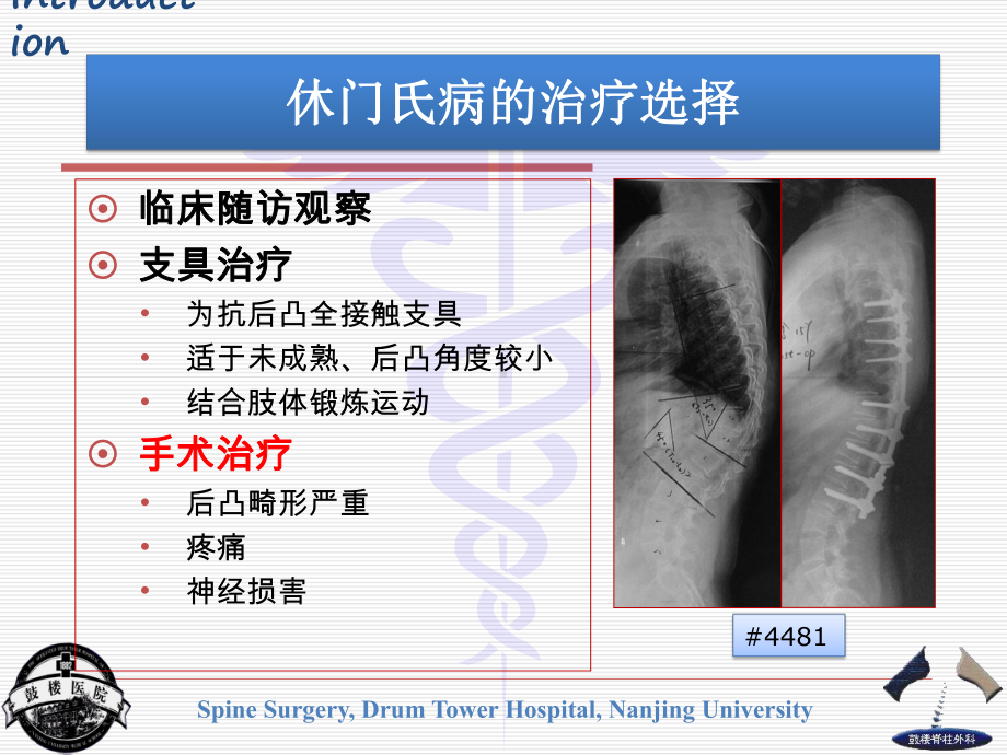 休门氏病课件.ppt_第3页