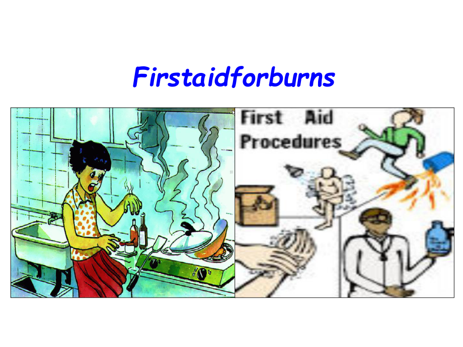 人教版高中英语必修五Unit5《Firstaid》课件reading(新).pptx(课件中不含音视频素材)_第3页