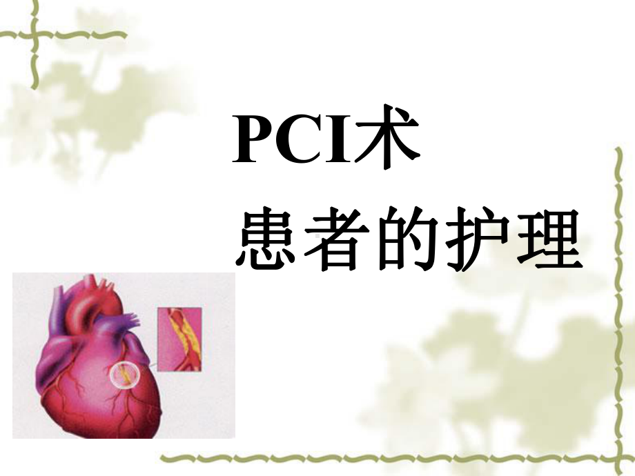 PTCA术患者护理简述课件.ppt_第1页