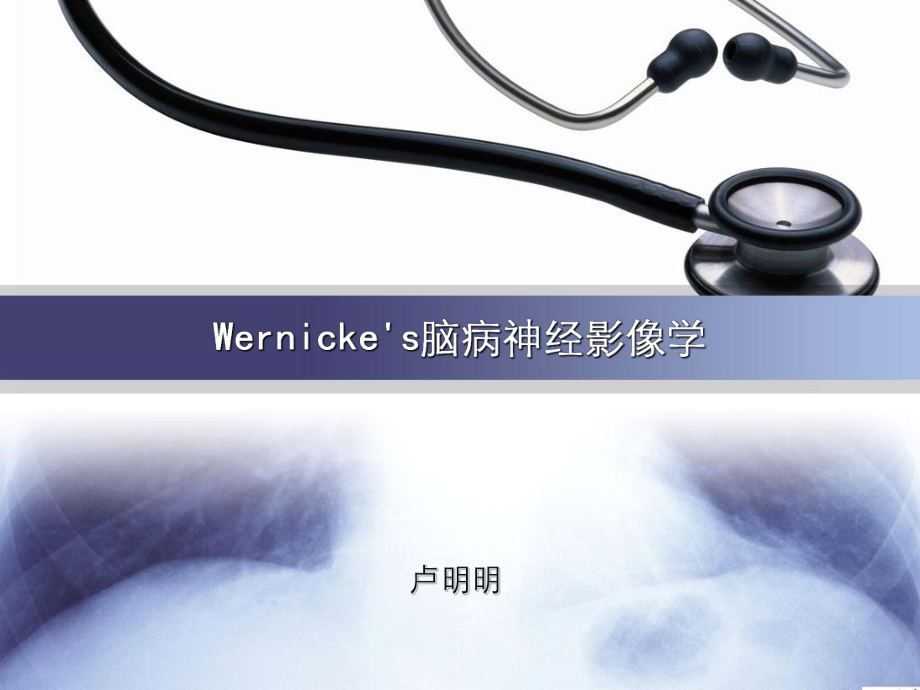 Wernicke脑病 CT表现 课件.ppt_第1页