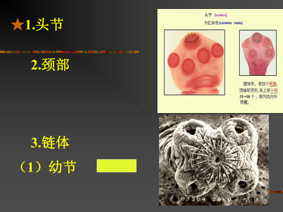 4带绦虫线虫概论蛔虫鞭虫(护本)[最新]课件.ppt_第3页