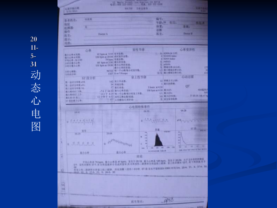 （课件教案） 双支冠脉痉挛（cas）致变异心绞痛1例.ppt_第3页