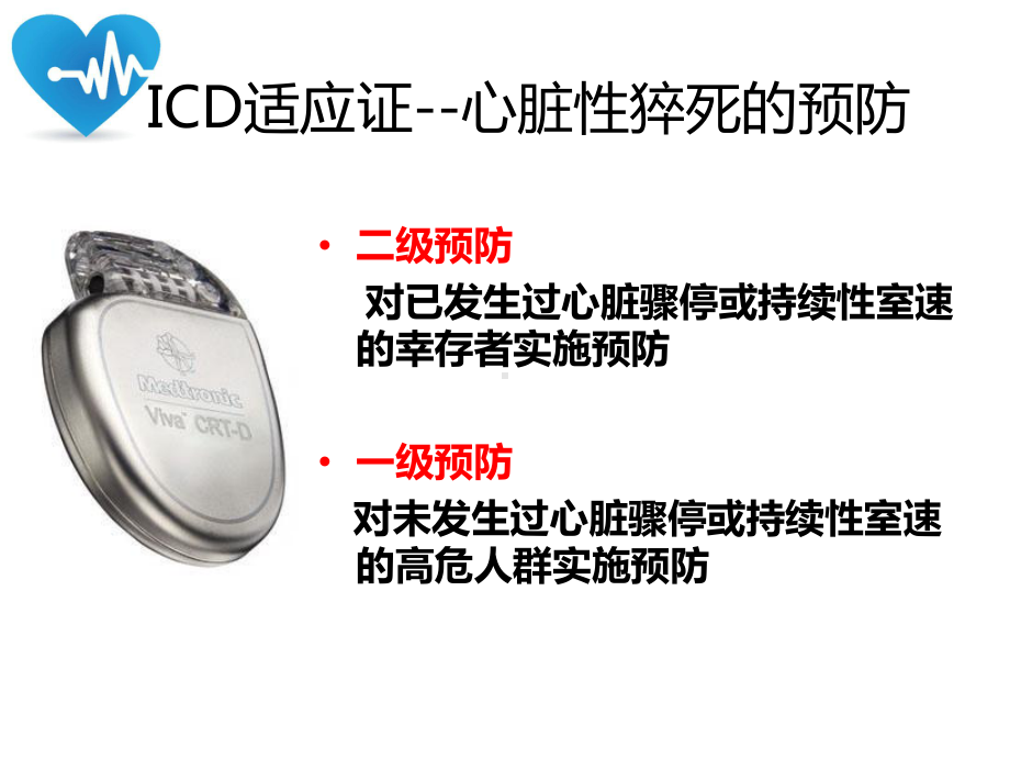 ICD患者的个性化程控策略课件.pptx_第3页