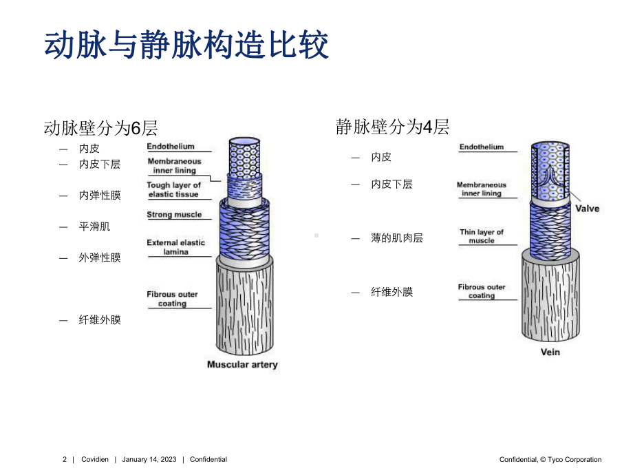 DVT病理基础及防治(患者教育)解读课件.ppt_第2页