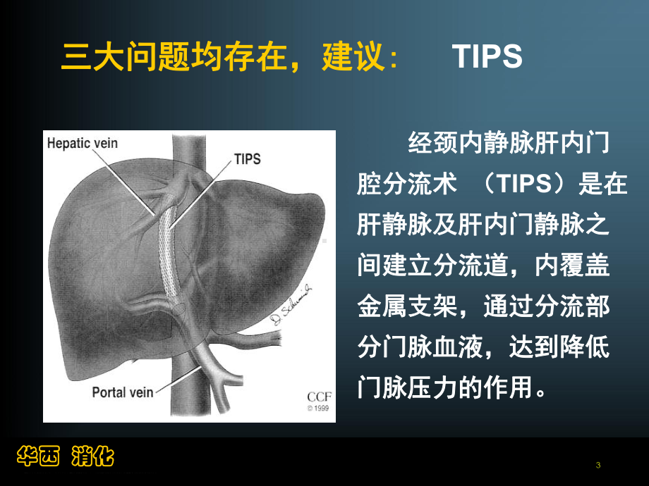 [生物医学）肝硬化门脉高压的介入治疗(四川大学华西医院消化内科唐承薇)课件.ppt_第3页