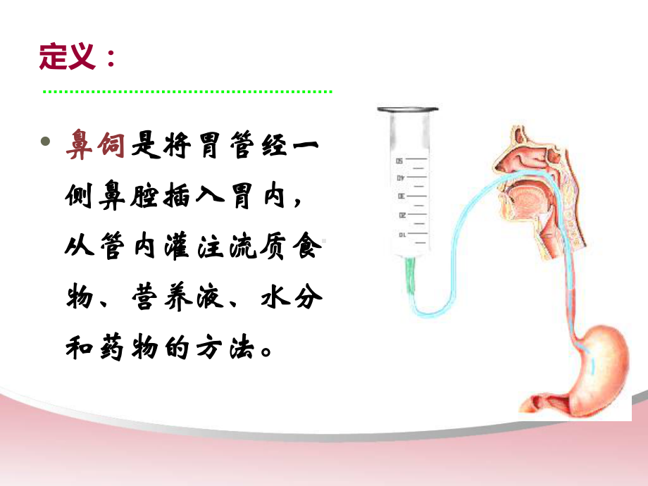 [网络教学]基础护理学课件鼻饲法.ppt_第2页