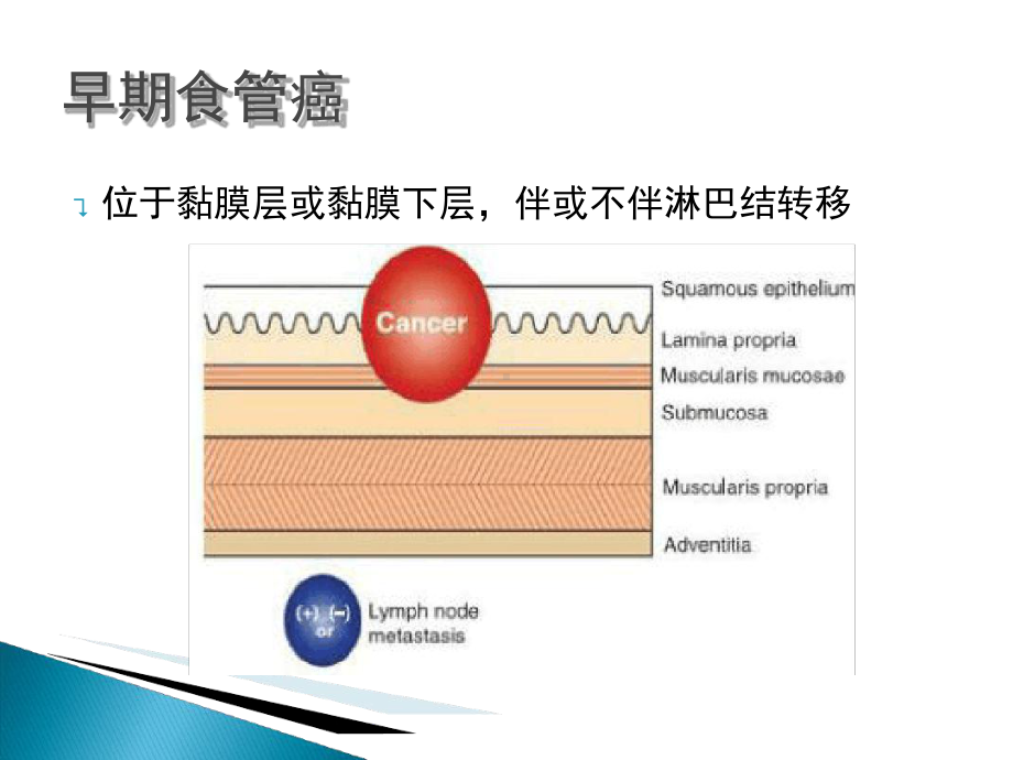 NBI+放大在食管早癌诊断中应用进展课件.ppt_第2页